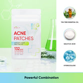 Pimple Patches for Face with Tea Tree Oil 132 pcs. Hydrocolloid Acne Pimple Patches. Blemish Patches, Acne Dots, Pimple Stickers, Acne Patch and Pimple Patch